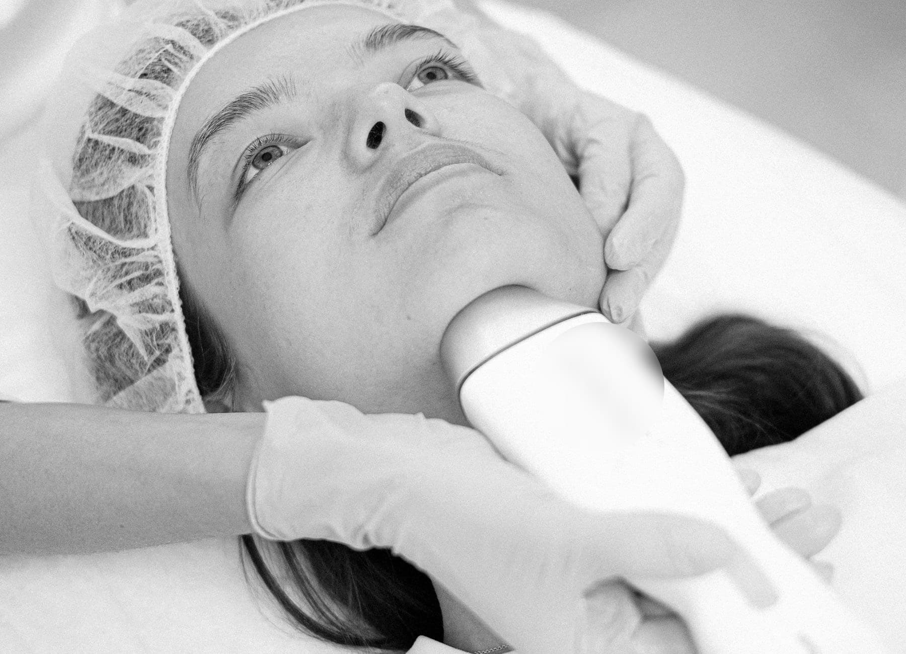 Lifting médical par ultrasons