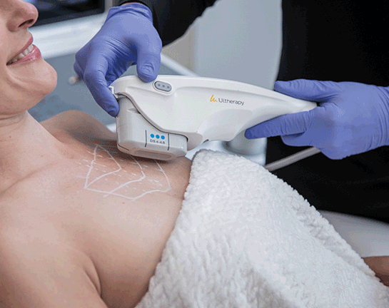 ultherapy-prime-traitement
