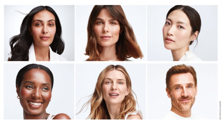 ULTHERAPY-PRIME-PATIENTS