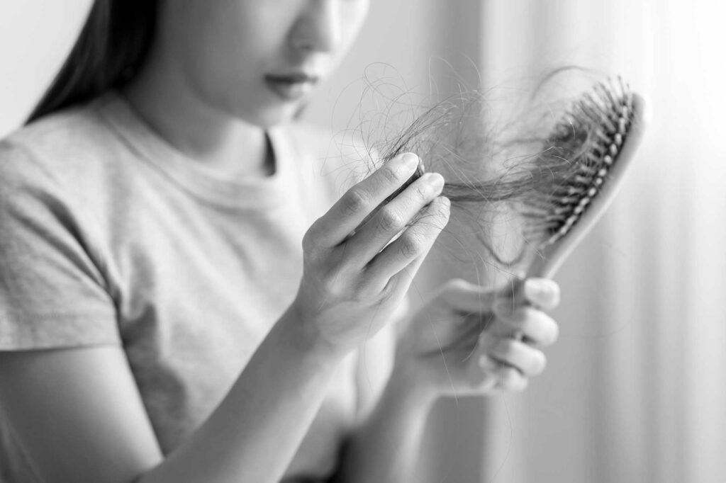 Perte de cheveux chez la femme à Clermond-Ferrant
