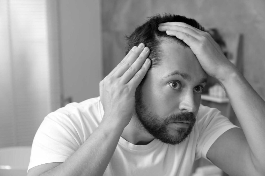 Perte de cheveux chez l’homme à Clermond-Ferrant