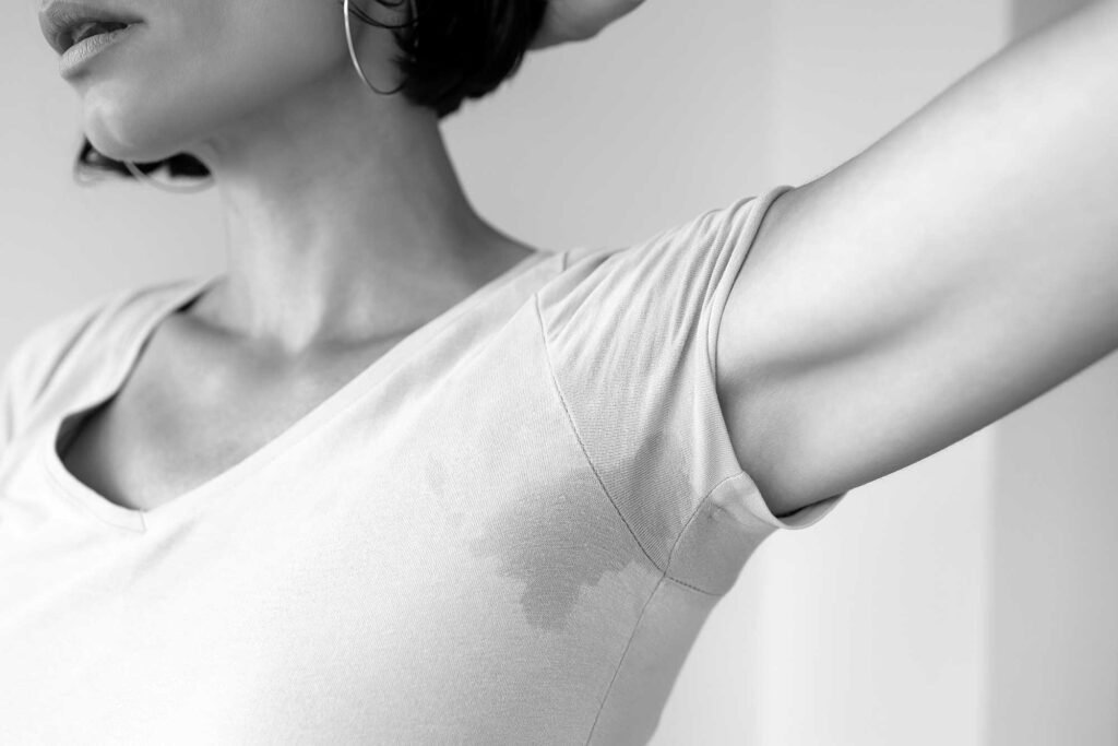 Soins de médecine esthétique pour la transpiration excessive